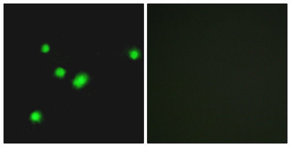 Immunofluorescence analysis of A549 cells, using MUTYH Antibody. The picture on the right is blocked with the synthesized peptide.