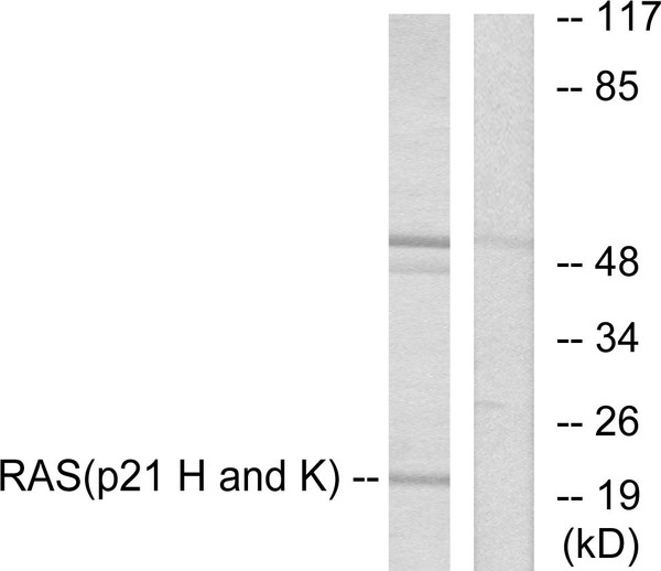 Western blot analysis of lysates from HeLa cells, using RASH/RASK Antibody. The lane on the right is blocked with the synthesized peptide.