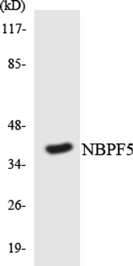 Western blot analysis of the lysates from K562 cells using NBPF5 antibody. Western blot analysis of the lysates from K562 cells using NBPF5 antibody.