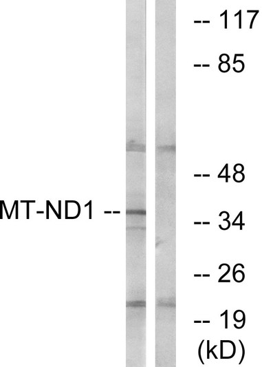 Western blot analysis of lysates from Jurkat cells, using MT-ND1 Antibody. The lane on the right is blocked with the synthesized peptide.