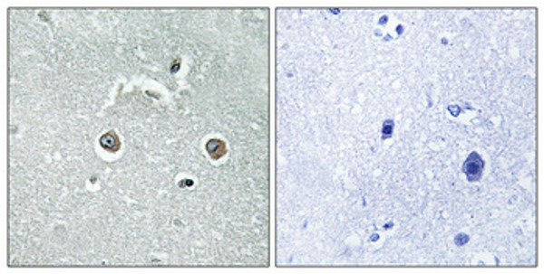 Immunohistochemical analysis of paraffin-embedded Human brain. Antibody was diluted at 1:100 (4°C overnight). High-pressure and temperature Tris-EDTA, pH8.0 was used for antigen retrieval. Negetive contrl (right) obtaned from antibody was pre-absorbed by immunogen peptide. Immunohistochemical analysis of paraffin-embedded Human brain. Antibody was diluted at 1:100 (4°C overnight). High-pressure and temperature Tris-EDTA, pH8.0 was used for antigen retrieval. Negetive contrl (right) obtaned from antibody was pre-absorbed by immunogen peptide.
