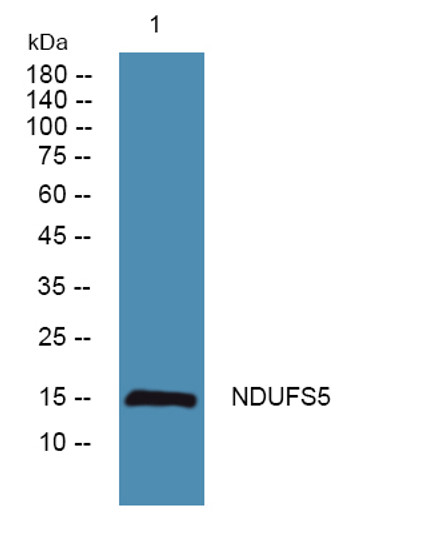 Western blot analysis of lysates from SH-SY5Y cells, primary antibody was diluted at 1:1000, 4°C over night