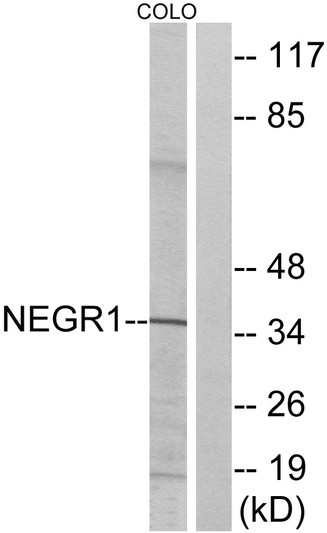 Western blot analysis of lysates from COLO cells, using NEGR1 Antibody. The lane on the right is blocked with the synthesized peptide.