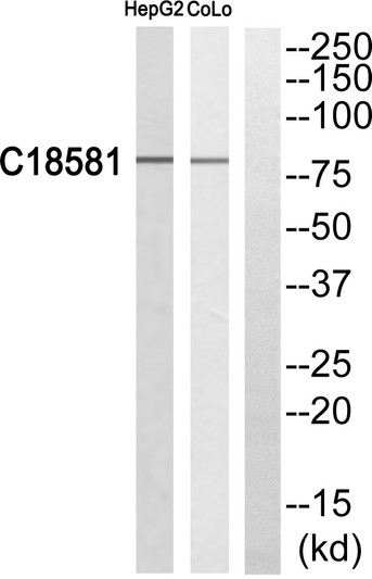 Western blot analysis of NEK5 Antibody. The lane on the right is blocked with the NEK5 peptide.