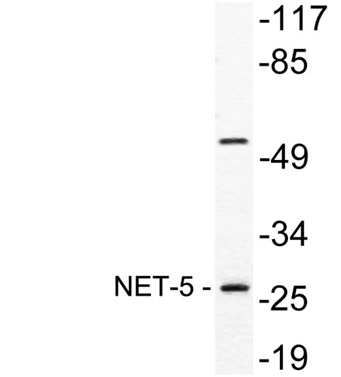 Western blot analysis of lysate from A549 cells, using NET-5 antibody.