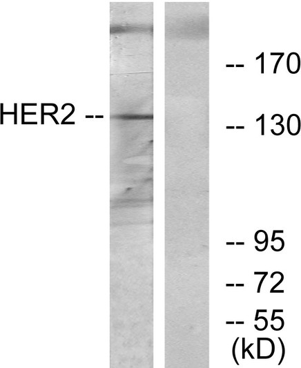 Western blot analysis of lysates from 293 cells, using HER2 Antibody. The lane on the right is blocked with the synthesized peptide.
