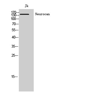 Western Blot analysis of Jk cells using Neurocan Polyclonal Antibody STJ94429