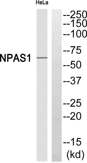 Western blot analysis of NPAS1 Antibody. The lane on the right is blocked with the NPAS1 peptide. STJ94436