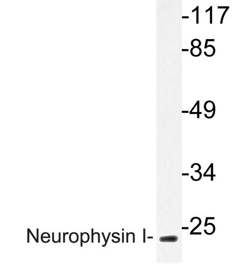 Western blot analysis of lysate from K562 cells, using Neurophysin I antibody. Western blot analysis of lysate from K562 cells, using Neurophysin I antibody.
