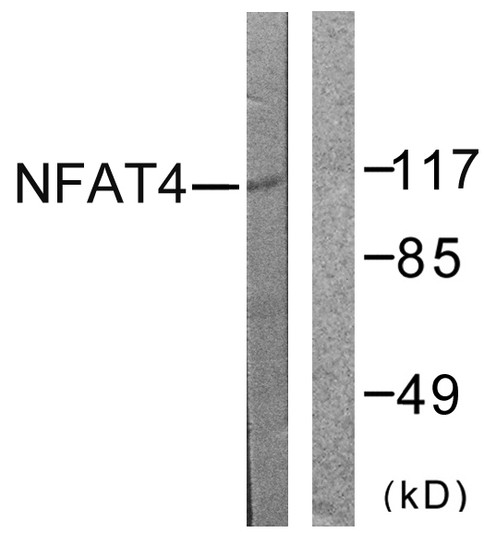 Western blot analysis of lysates from HeLa cells, treated with Ca+ 40nM 30', using NFAT4 Antibody. The lane on the right is blocked with the synthesized peptide.