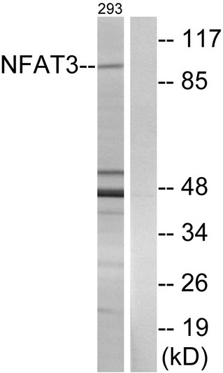 Western blot analysis of lysates from 293 cells, using NFAT3 Antibody. The lane on the right is blocked with the synthesized peptide.