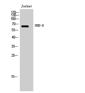 Western blot analysis of Jurkat cells using NHE-8 Polyclonal Antibody STJ94484