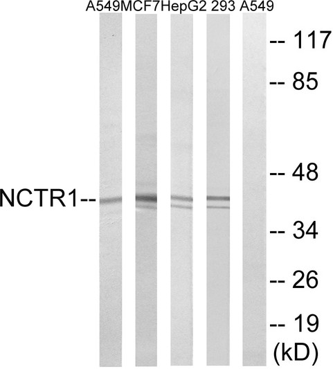 Western blot analysis of lysates from 293, HepG2, MCF-7, and A549 cells, using NCR1 Antibody. The lane on the right is blocked with the synthesized peptide.