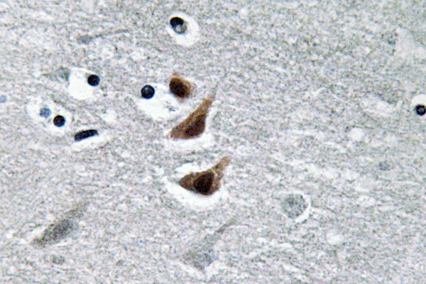 Immunohistochemistry analysis of NM23-H1 antibody in paraffin-embedded human brain tissue.