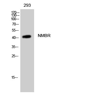 Western blot analysis of 293 cells using NMBR Polyclonal Antibody STJ94513