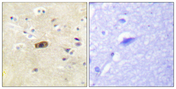 Immunohistochemistry analysis of paraffin-embedded human brain tissue, using NMDAR2A/B Antibody. The picture on the right is blocked with the synthesized peptide. Immunohistochemistry analysis of paraffin-embedded human brain tissue, using NMDAR2A/B Antibody. The picture on the right is blocked with the synthesized peptide.