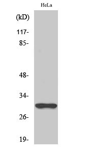 Western blot analysis of Jurkat cells using NQO1 Polyclonal Antibody diluted at 1：2000