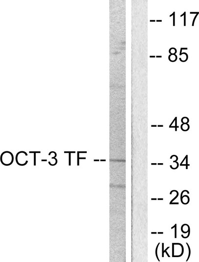 Western blot analysis of lysates from HeLa cells, using OCT3 Antibody. The lane on the right is blocked with the synthesized peptide.