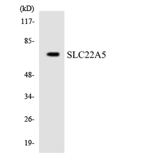 Western blot analysis of the lysates from HeLa cells using SLC22A5 antibody.