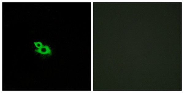 Immunofluorescence analysis of MCF7 cells, using OR2A42 Antibody. The picture on the right is blocked with the synthesized peptide. Immunofluorescence analysis of MCF7 cells, using OR2A42 Antibody. The picture on the right is blocked with the synthesized peptide.