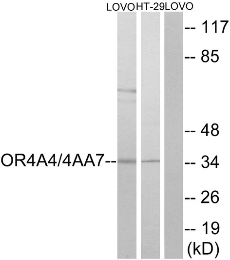 Western blot analysis of lysates from LOVO cells and HT29 cells, using OR4A4/4A47 Antibody. The lane on the right is blocked with the synthesized peptide. Western blot analysis of lysates from LOVO cells and HT29 cells, using OR4A4/4A47 Antibody. The lane on the right is blocked with the synthesized peptide.