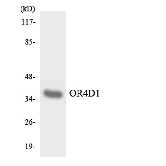 Western blot analysis of the lysates from HepG2 cells using OR4D1 antibody. Western blot analysis of the lysates from HepG2 cells using OR4D1 antibody.