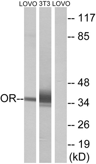 Western blot analysis of lysates from LOVO and NIH/3T3 cells, using OR4D6 Antibody. The lane on the right is blocked with the synthesized peptide.