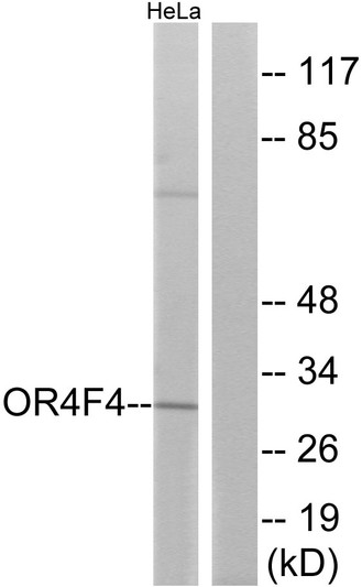 Western blot analysis of lysates from HeLa cells, using OR4F4 Antibody. The lane on the right is blocked with the synthesized peptide.