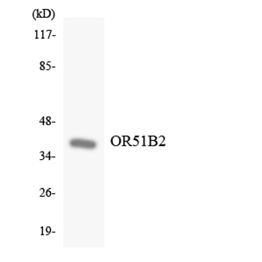 Western blot analysis of the lysates from K562 cells using OR51B2 antibody. Western blot analysis of the lysates from K562 cells using OR51B2 antibody.