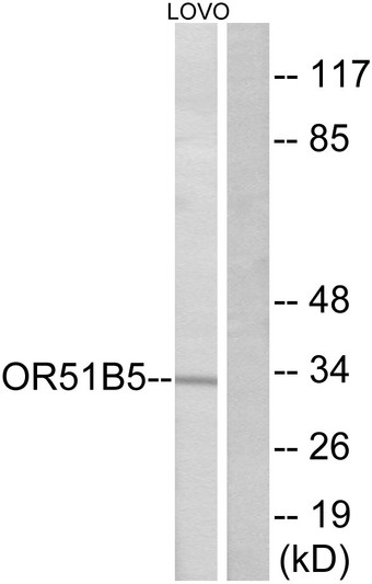 Western blot analysis of lysates from LOVO cells, using OR51B5 Antibody. The lane on the right is blocked with the synthesized peptide.