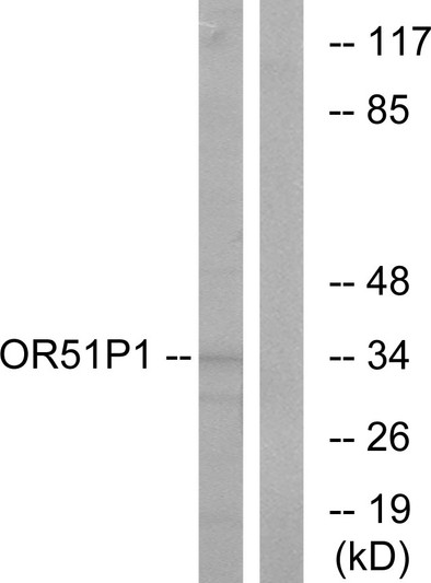 Western blot analysis of lysates from Jurkat cells, using OR51D1 Antibody. The lane on the right is blocked with the synthesized peptide.