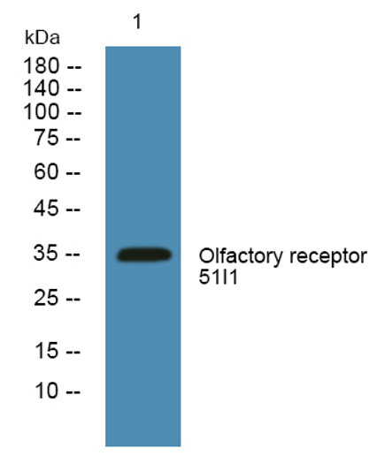 Western blot analysis of lysates from KB cells, primary antibody was diluted at 1:1000, 4°C over night Western blot analysis of lysates from KB cells, primary antibody was diluted at 1:1000, 4°C over night