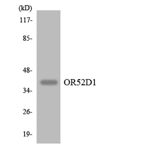Western blot analysis of the lysates from HepG2 cells using OR52D1 antibody. Western blot analysis of the lysates from HepG2 cells using OR52D1 antibody.