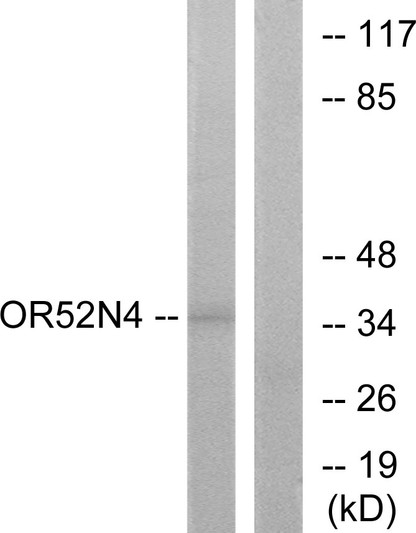 Western blot analysis of lysates from HeLa cells, using OR52N4 Antibody. The lane on the right is blocked with the synthesized peptide.