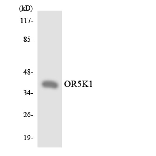 Western blot analysis of the lysates from HeLa cells using OR5K1 antibody. Western blot analysis of the lysates from HeLa cells using OR5K1 antibody.