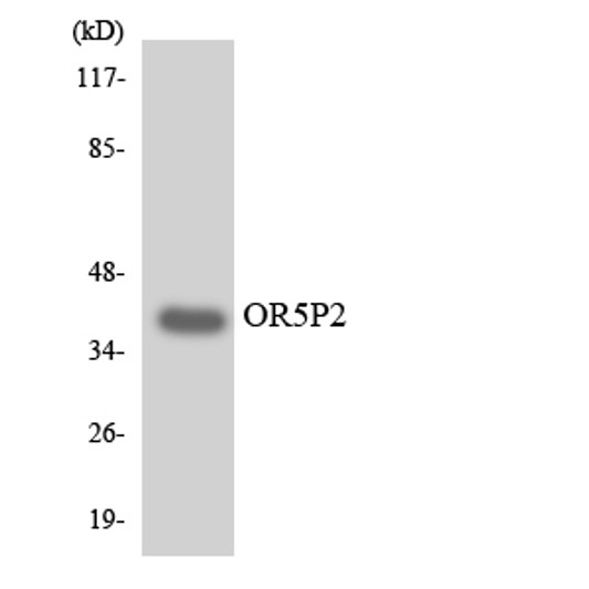 Western blot analysis of the lysates from K562 cells using OR5P2 antibody.