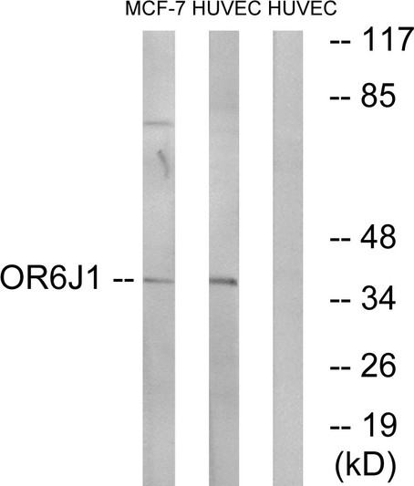 Western blot analysis of lysates from HUVEC and MCF-7 cells, using OR6J1 Antibody. The lane on the right is blocked with the synthesized peptide.