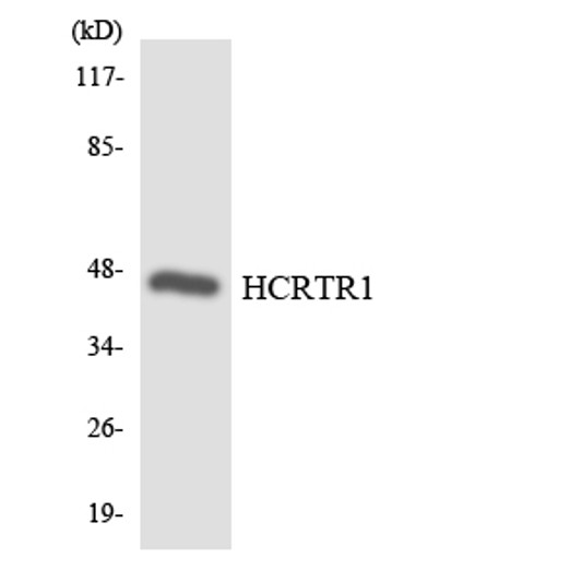 Western blot analysis of the lysates from HepG2 cells using HCRTR1 antibody. Western blot analysis of the lysates from HepG2 cells using HCRTR1 antibody.