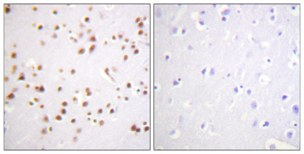 Immunohistochemistry analysis of paraffin-embedded human brain tissue, using Catenin-delta1 Antibody. The picture on the right is blocked with the synthesized peptide.