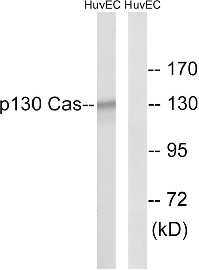 Western blot analysis of lysates from HUVEC cells, using p130 Cas Antibody. The lane on the right is blocked with the synthesized peptide.