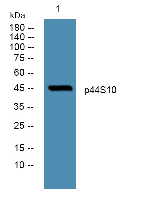 Western blot analysis of lysates from K562 cells, primary antibody was diluted at 1:1000, 4° overnight STJ94882