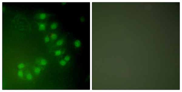 Immunofluorescence analysis of A549 cells, using p63 Antibody. The picture on the right is blocked with the synthesized peptide.