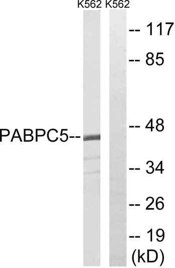 Western blot analysis of lysates from K562 cells, using PABPC5 Antibody. The lane on the right is blocked with the STJ94929
