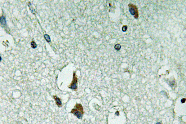 Immunohistochemistry analysis of PAH antibody in paraffin-embedded human brain tissue.