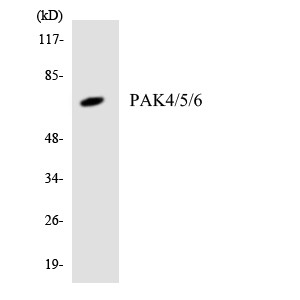 Western blot analysis of the lysates from Jurkat cells using PAK4/5/6 antibody.