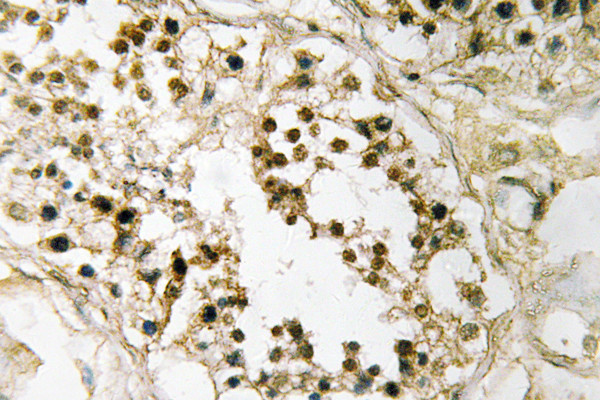 Immunohistochemistry analysis of Pax-2 antibody in paraffin-embedded human testis tissue. Immunohistochemistry analysis of Pax-2 antibody in paraffin-embedded human testis tissue.