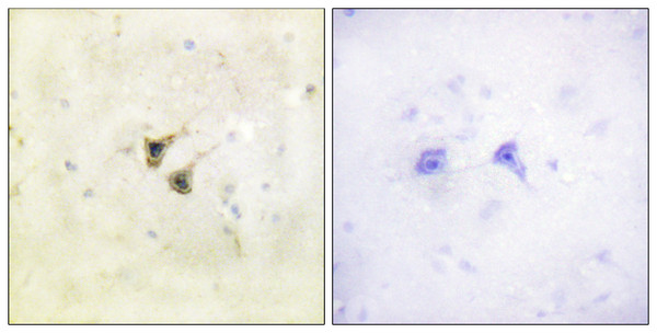 Immunohistochemistry analysis of paraffin-embedded human brain tissue, using PBK/TOPK Antibody. The picture on the right is blocked with the synthesized peptide.