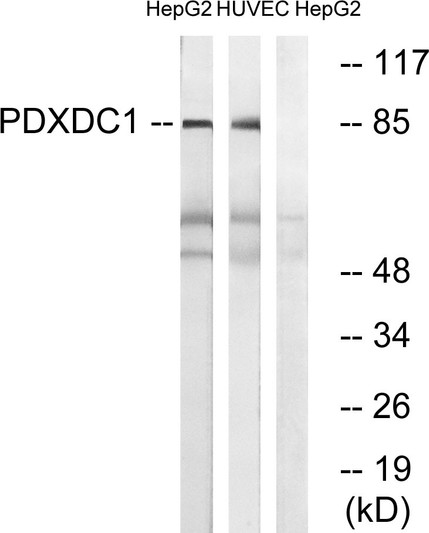 Western blot analysis of lysates from HepG2 and HUVEC cells, using PDXDC1 Antibody. The lane on the right is blocked with the synthesized peptide.
