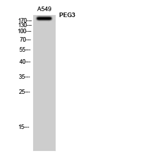 Western Blot analysis of A549 cells using PEG3 Polyclonal Antibody STJ95024