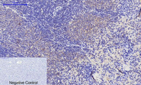 Immunohistochemical analysis of paraffin-embedded Rat-liver tissue. 1, PERK Polyclonal Antibody was diluted at 1:200 (4°C, overnight). 2, Sodium citrate pH 6.0 was used for antibody retrieval (>98°C, 20min). 3, Secondary antibody was diluted at 1:200 (room tempeRature, 30min). Negative control was used by secondary antibody only.